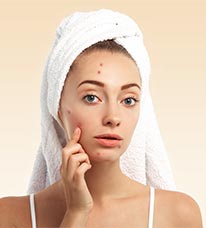 adolescent acne phyto naturopathe Clermont l'Hérault