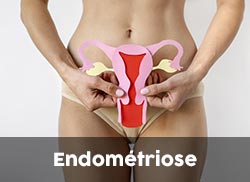 Traitement Endometriose Naturopathie Médecine douce Montpellier